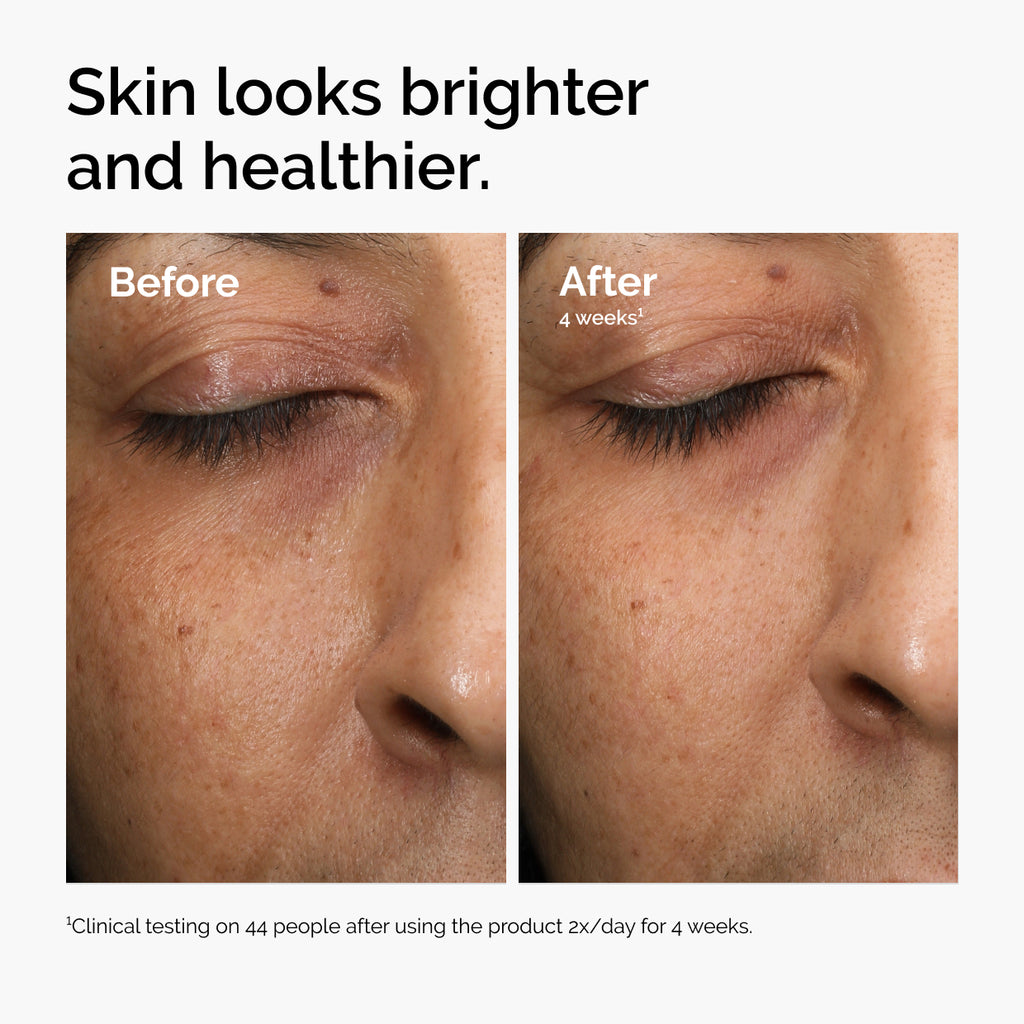 The Ordinary Multi-Antioxidant Radiance Serum for antioxidant support | 30ml, morning & evening use