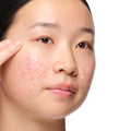 The Ordinary Aloe 2% + NAG 2% Solution Water-Based Serum for uneven skin tone | 30ml, morning & evening use