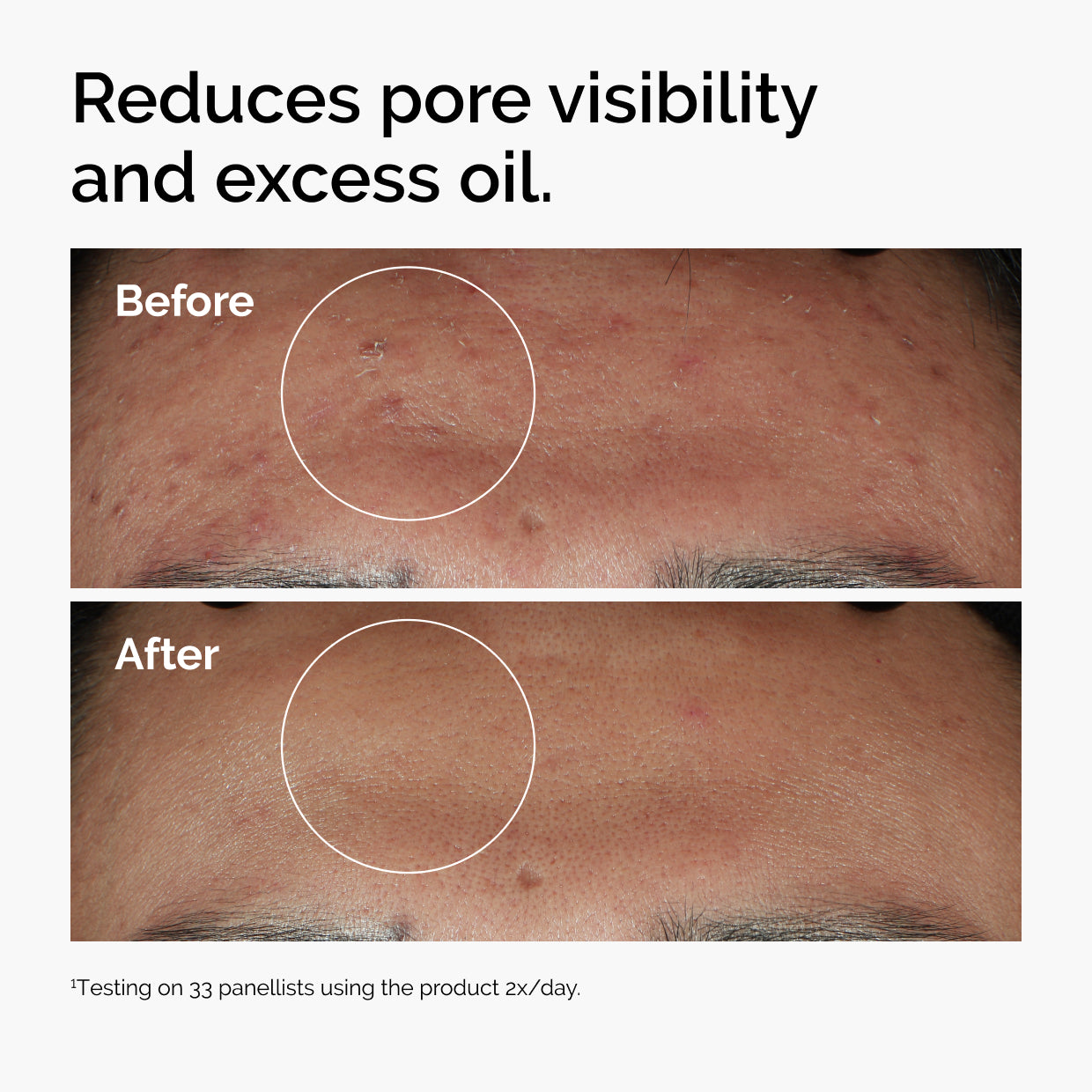 The Ordinary Niacinamide 10% + Zinc 1% Water-Based Serum for textural irregularities | 30ml/60ml, morning & evening use