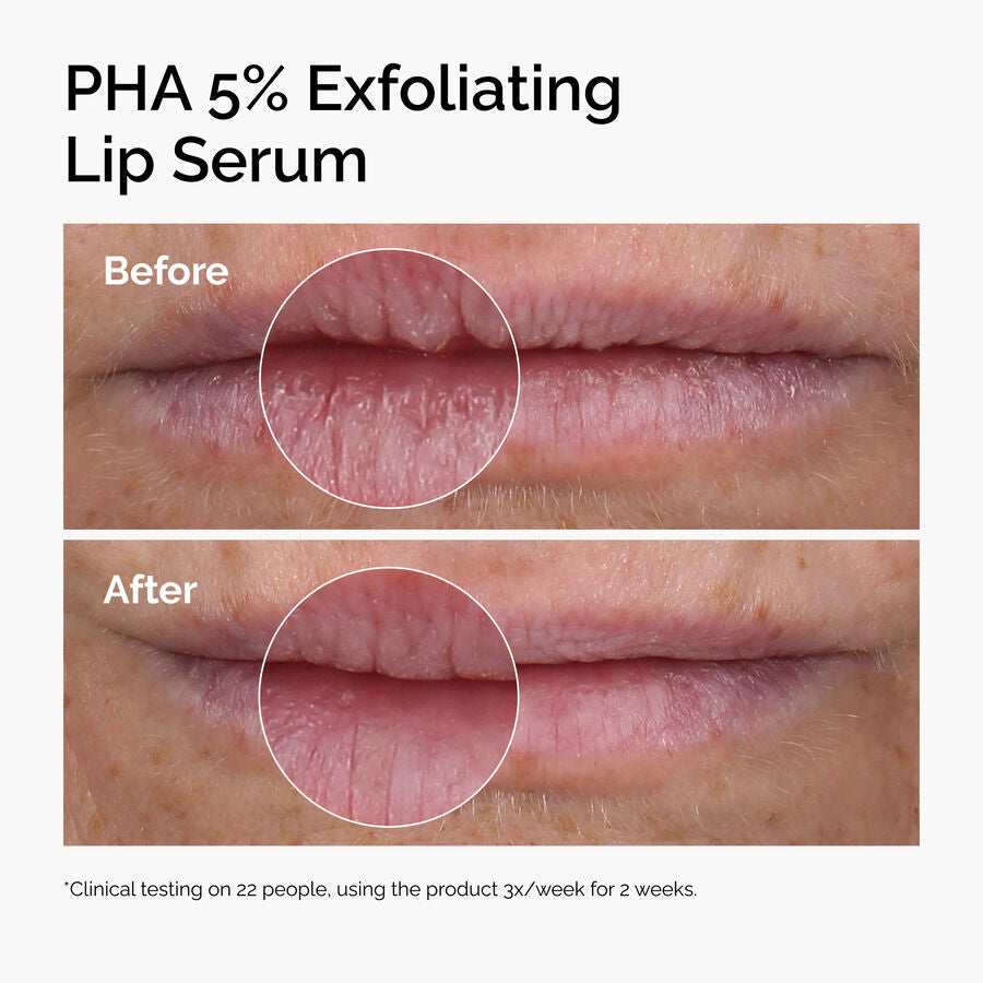 The Ordinary PHA 5% Exfoliating Lip Serum for dryness | 15ml, evening use