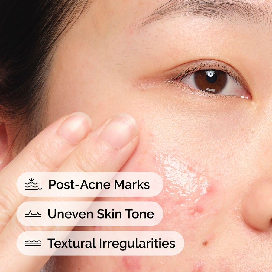 The Ordinary Aloe 2% + NAG 2% Solution Water-Based Serum for uneven skin tone | 30ml, morning & evening use