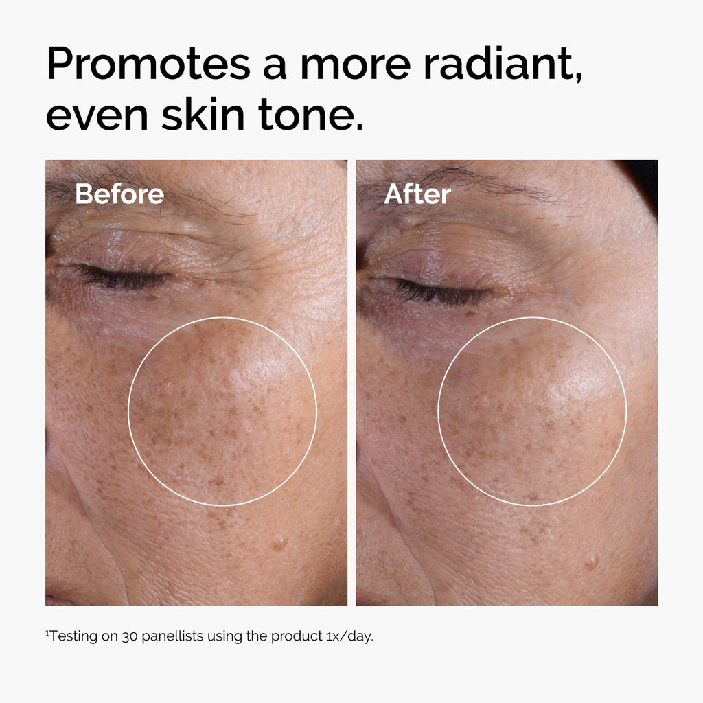 The Ordinary Glycolic Acid 7% Exfoliating Toner for dullness | 100ml/240ml, evening use