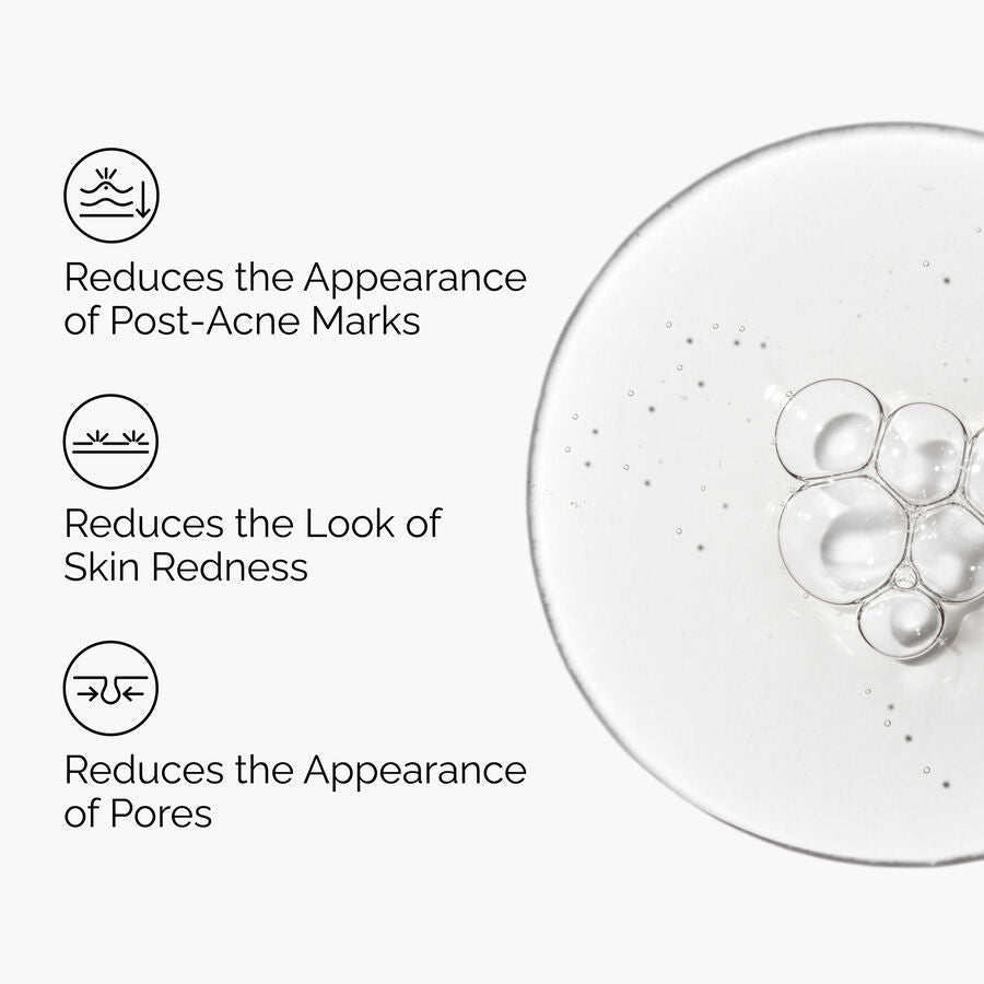 The Ordinary Aloe 2% + NAG 2% Solution Water-Based Serum for uneven skin tone | 30ml, morning & evening use