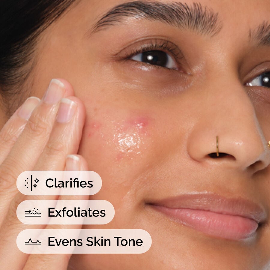 The Ordinary Salicylic Acid 2% Anhydrous Solution for signs of congestion | 30ml, morning & evening use