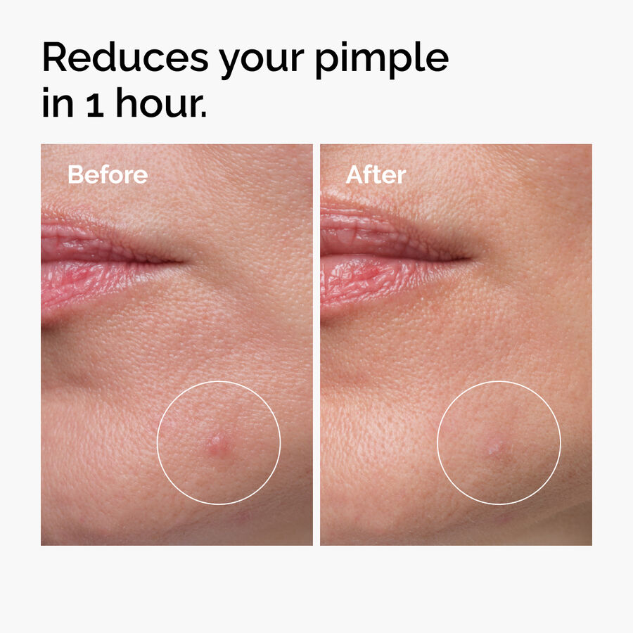 The Ordinary Sulfur 10% Powder-to-Cream Concentrate for visible shine | 5g, morning & evening use