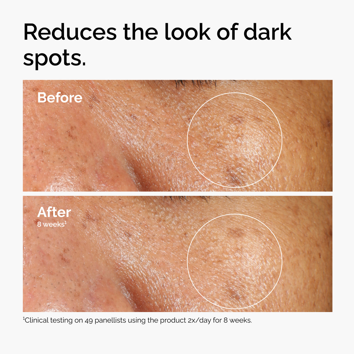The Ordinary Alpha Arbutin 2% + HA Water-Based Serum for uneven skin tone | 30ml/60ml, morning & evening use