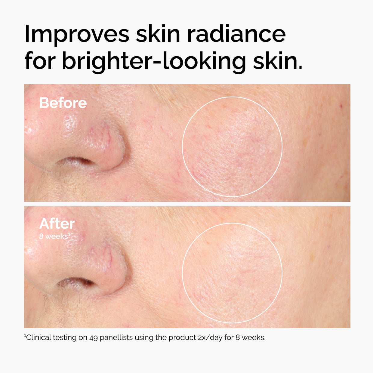 The Ordinary Alpha Arbutin 2% + HA Water-Based Serum for uneven skin tone | 30ml/60ml, morning & evening use