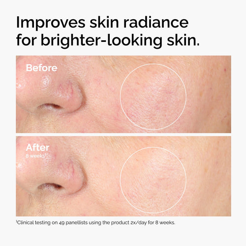 The Ordinary Alpha Arbutin 2% + HA Water-Based Serum for uneven skin tone | 30ml/60ml, morning & evening use