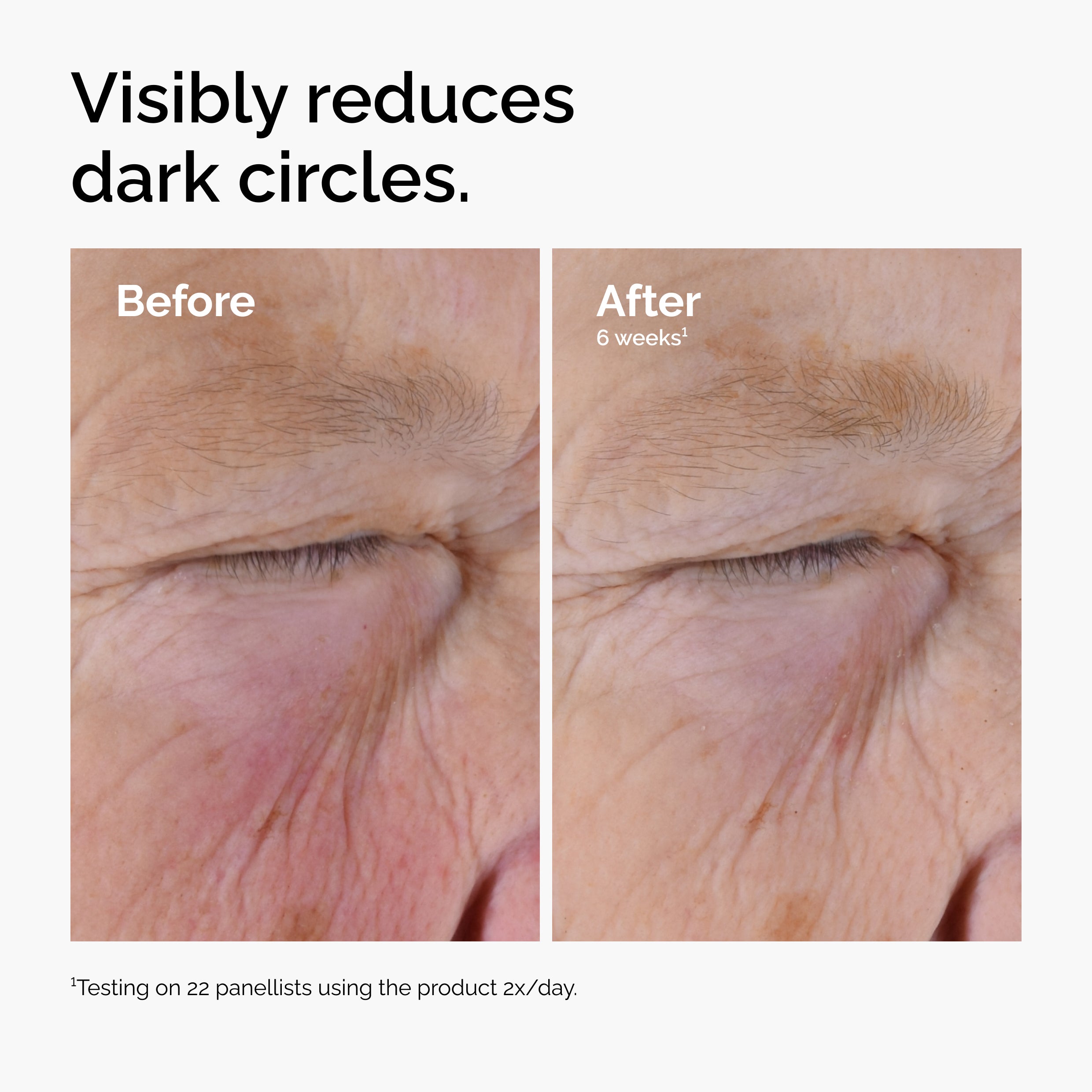 The Ordinary Caffeine Solution 5% + EGCG Eye Serum for dark circles | 30ml, morning & evening use